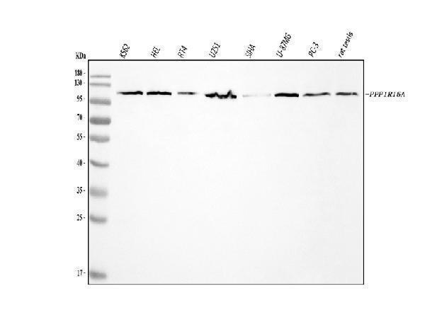  Western blot analysis of GADD34/PPP1R15A using anti-GADD34/PPP1R15A antibody (A02394-2)
