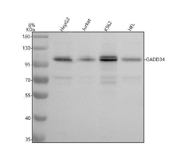Western blot analysis of GADD34/PPP1R15A using anti-GADD34/PPP1R15A antibody (A02394-5)