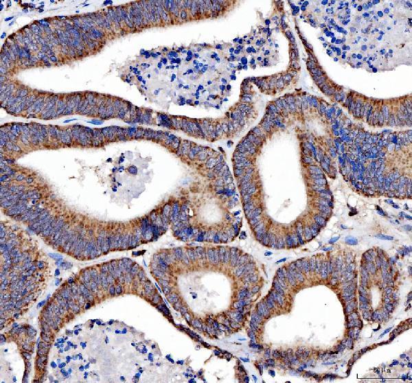 IHC analysis of SIRT5 using anti-SIRT5 antibody (A02395-3)
