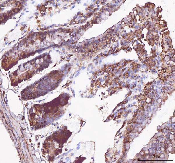 IHC analysis of SIRT5 using anti-SIRT5 antibody (A02395-3)