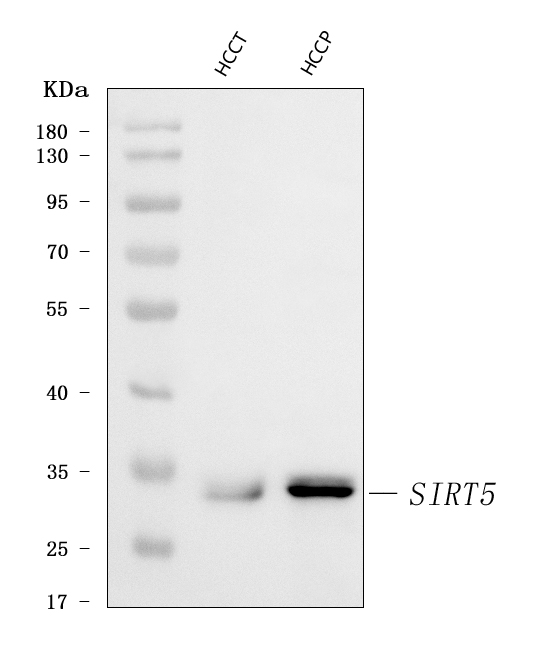  Western blot analysis of SIRT5 using anti-SIRT5 antibody (A02395-3)