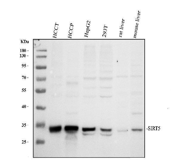 Western blot analysis of FRZB using anti-FRZB antibody (A03539-2)