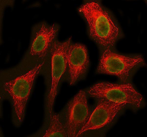  IF analysis of SBDS using anti-SBDS antibody (A02396-1) and anti-Beta Tubulin antibody (M01857-3)