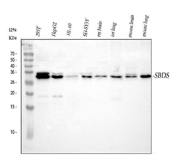  Western blot analysis of SBDS using anti-SBDS antibody (A02396-1)