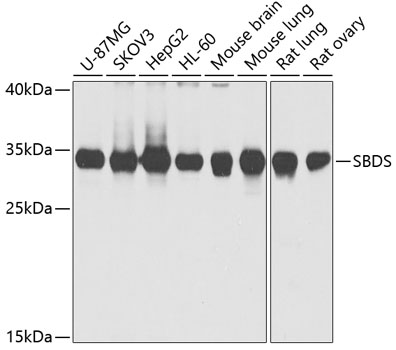 Western blot analysis of extracts of various cell lines, using SBDS antibody  at 1:1000 dilution