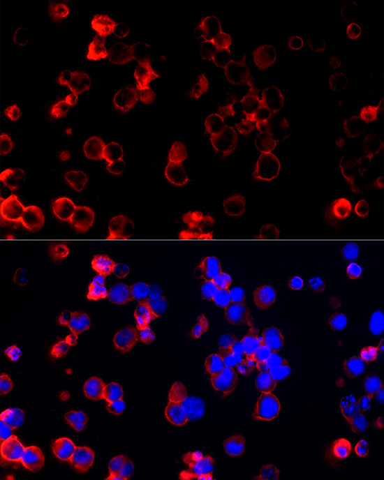 a02397 clic1 primary antiboties if testing 3