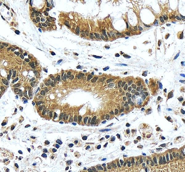 IHC analysis of CSNK2A1 using anti-CSNK2A1 antibody (A02398-2)