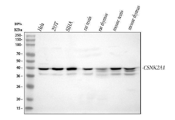  Western blot analysis of CSNK2A1 using anti-CSNK2A1 antibody (A02398-2)