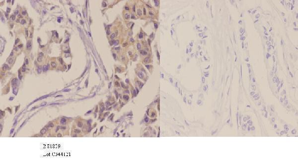  Immunohistochemistry validation of CSNK2A1 using Anti-Casein Kinase II Alpha (T251) CSNK2A1 Antibody (A02398T251)