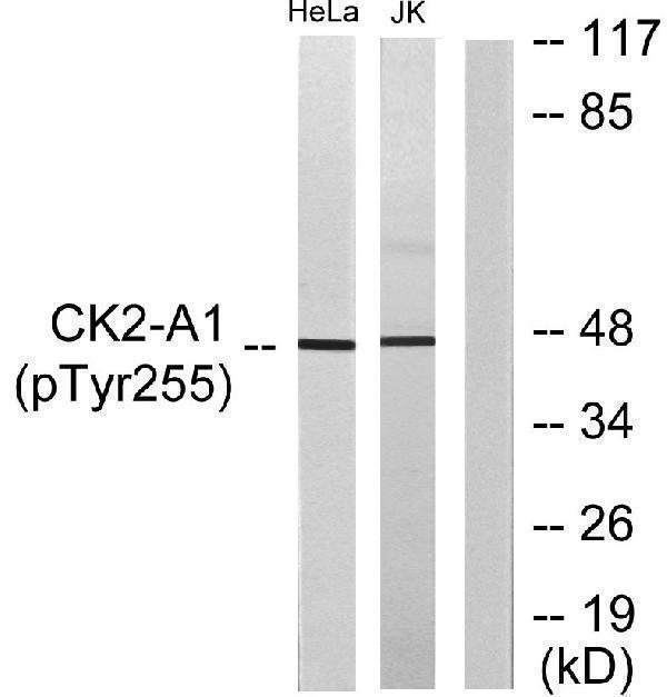 Western blot analysis of lysates from HeLa cells and Jurkat cells, using Casein Kinase II alpha (Phospho-Tyr255) Antibody