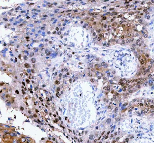 a02399 1 lta4h primary antibodies ihc testing 2