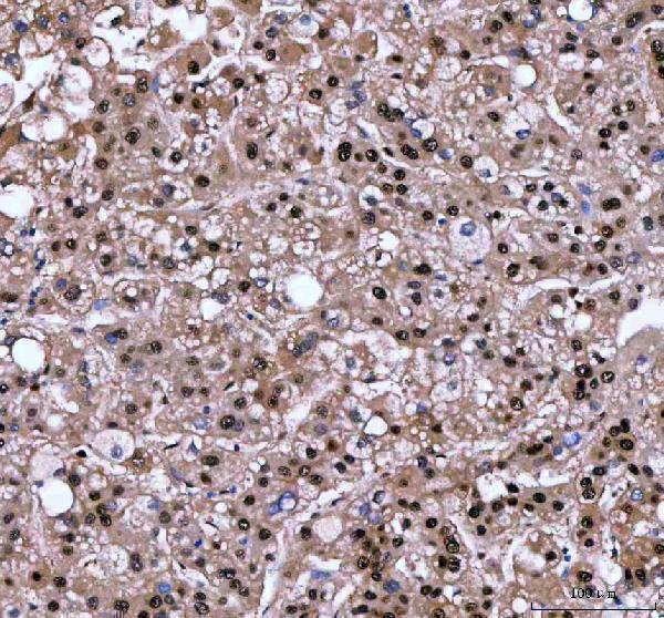 a02399 1 lta4h primary antibodies ihc testing 3