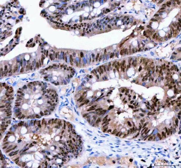 a02399 1 lta4h primary antibodies ihc testing 4