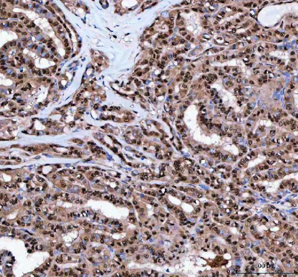 a02399 1 lta4h primary antibodies ihc testing 5