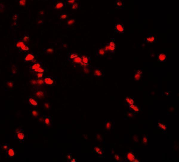 Immunofluorescence of Nucleobindin-2 in rat brain tissue with Nucleobindin-2 antibody at 20 μg/ml
