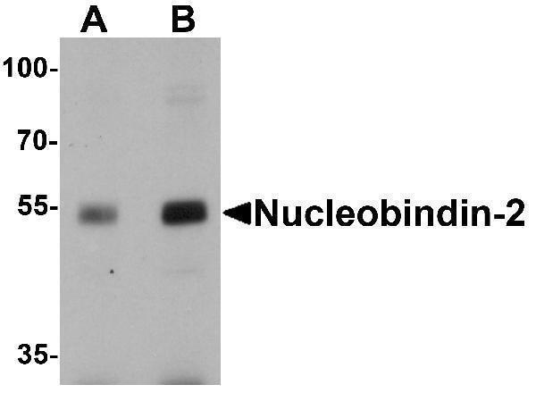 Western blot analysis of Nucleobindin-2 in rat brain tissue lysate with Nucleobindin-2 antibody at (A) 0