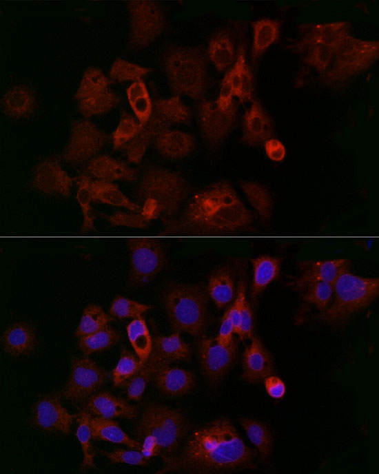 Immunofluorescence analysis of HeLa cells using Ferritin Heavy Chain Rabbit pAb  at dilution of 1:200 