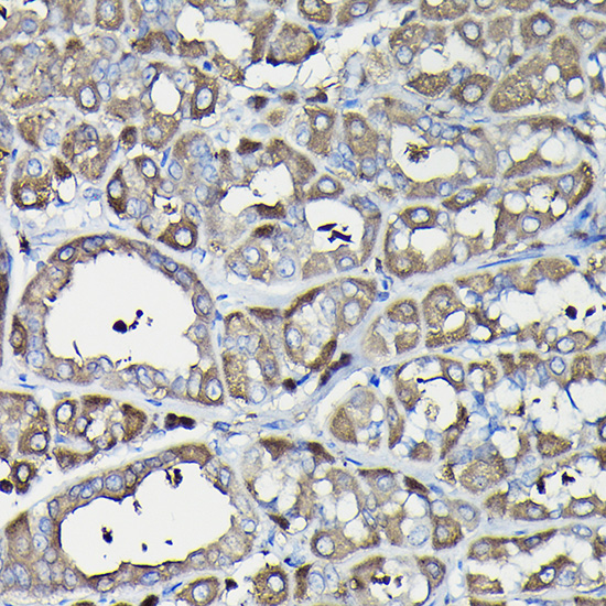 Immunohistochemistry of paraffin-embedded rat stomach using Ferritin Heavy Chain Rabbit pAb  at dilution of 1:100 