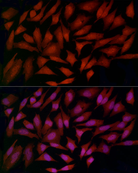 a02401 fth1 primary antiboties ihc testing 3