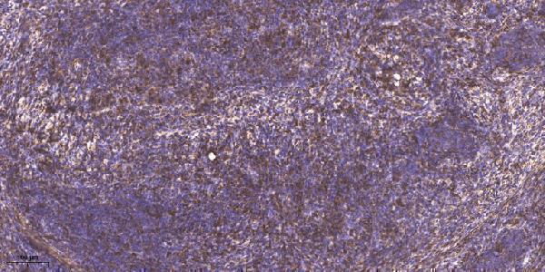 a02403 1 kat2b primary antibodies ihc testing 1