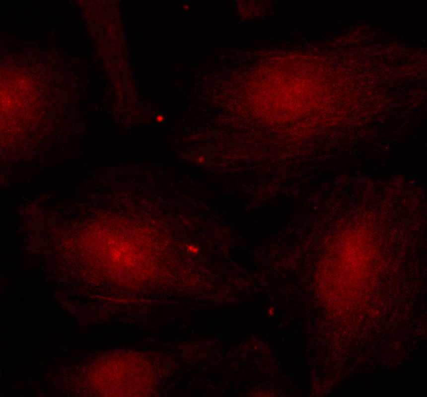 a02403 3 kat2b primary antibodies if testing 1