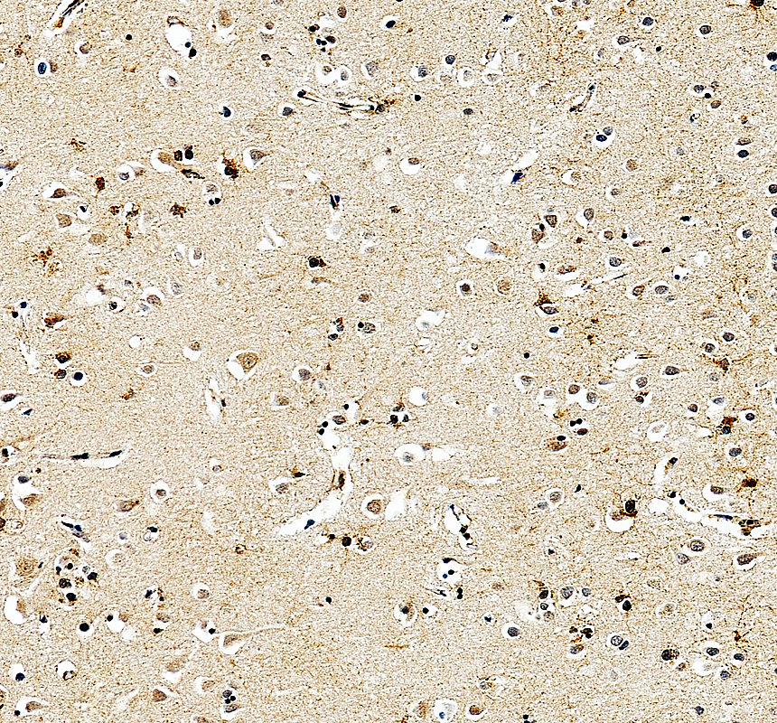 IHC analysis of KAT2B using anti-KAT2B antibody (A02403-3)