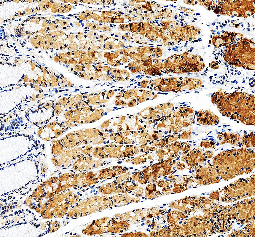 IHC analysis of KAT2B using anti-KAT2B antibody (A02403-3)