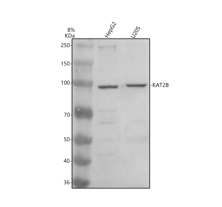 Western blot analysis of KAT2B using anti-KAT2B antibody (A02403-3)