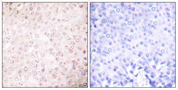 a02403 kat2b primary antibodies ihc testing 1