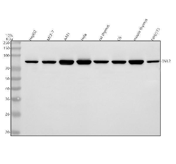  Western blot analysis of DVL2 using anti-DVL2 antibody (A02404-4)