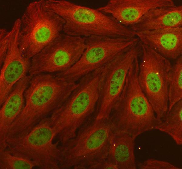 IF analysis of DCLRE1C using anti-DCLRE1C antibody (A02405-2) and anti-Alpha Tubulin antibody (M03989-3)