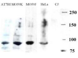 Western blot using Boster
