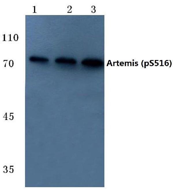 Western blot (WB) analysis of p-Artemis (S516) polyclonal antibody at 1:500 dilution
Lane1:HEK293T cell lysate
Lane2:Mouse skeletal muscle tissue lysate
Lane3:Rat skeletal muscle tissue lysate