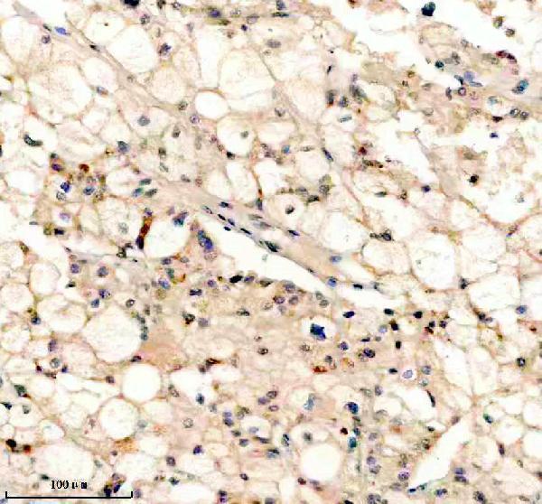 IHC analysis of PEX5 using anti-PEX5 antibody (A02406-2)