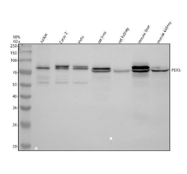 Western blot analysis of PEX5 using anti-PEX5 antibody (A02406-2)