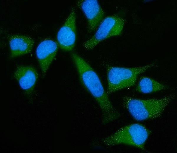 a02407 2 gnb3 primary antibodies if testing 8