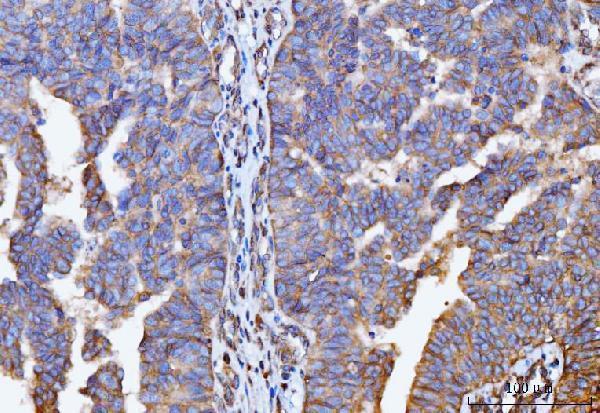  IHC analysis of GNB3 using anti-GNB3 antibody (A02407-2)