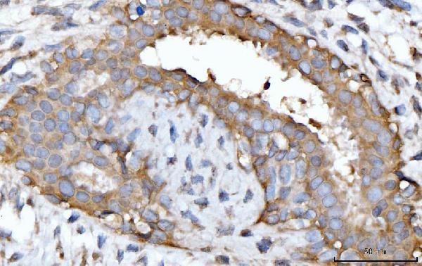 a02407 2 gnb3 primary antibodies ihc testing 4