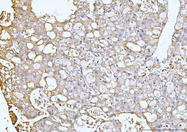 a02407 2 gnb3 primary antibodies ihc testing 5