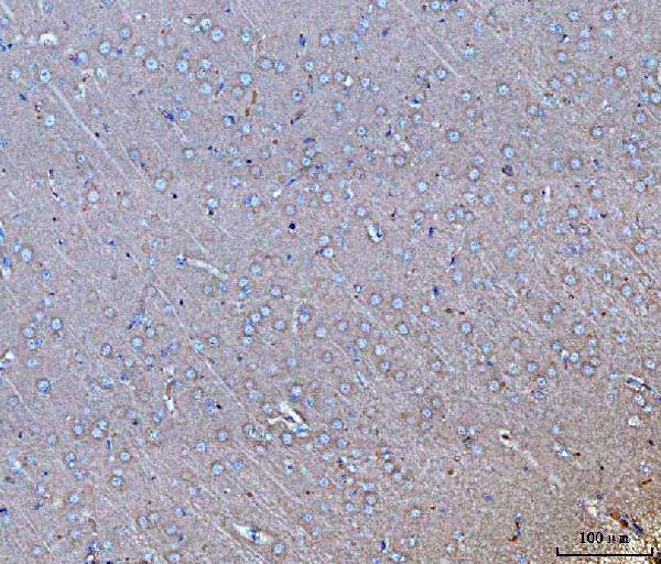 a02407 2 gnb3 primary antibodies ihc testing 7