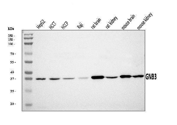  Western blot analysis of GNB3 using anti-GNB3 antibody (A02407-2)