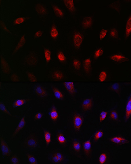 Immunofluorescence analysis of U-251MG cells using GNB3 Rabbit pAb  at dilution of 1:50 