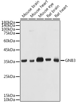 Western blot analysis of extracts of various cell lines, using GNB3 antibody  at 1:1000 dilution