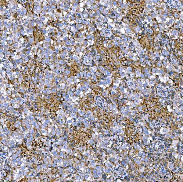 a02409 1 rab7a primary antibodies ihc testing 11