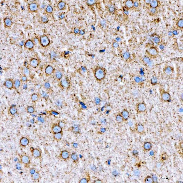 a02409 1 rab7a primary antibodies ihc testing 14