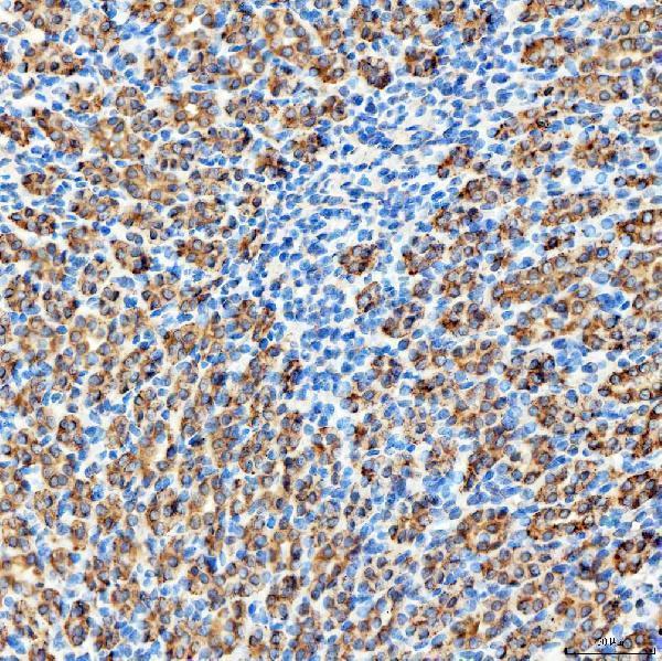 a02409 1 rab7a primary antibodies ihc testing 16