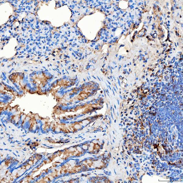 a02409 1 rab7a primary antibodies ihc testing 17