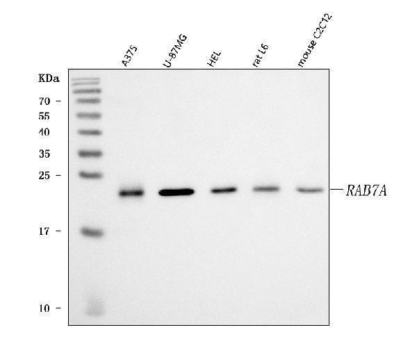 a02409 1 rab7a primary antibodies wb testing 1