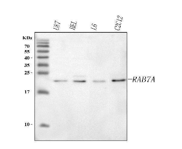  Western blot analysis of RAB7A using anti-RAB7A antibody (A02409-2)