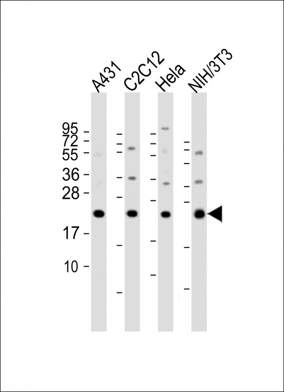 a02409 anti rab7 antibody c term wb testing 3
